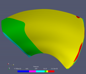 geomBEST_it1_pressure1_2